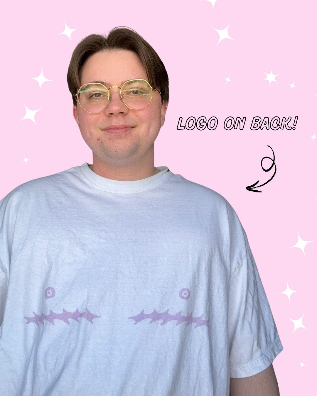 Top Surgery Scars T-shirt