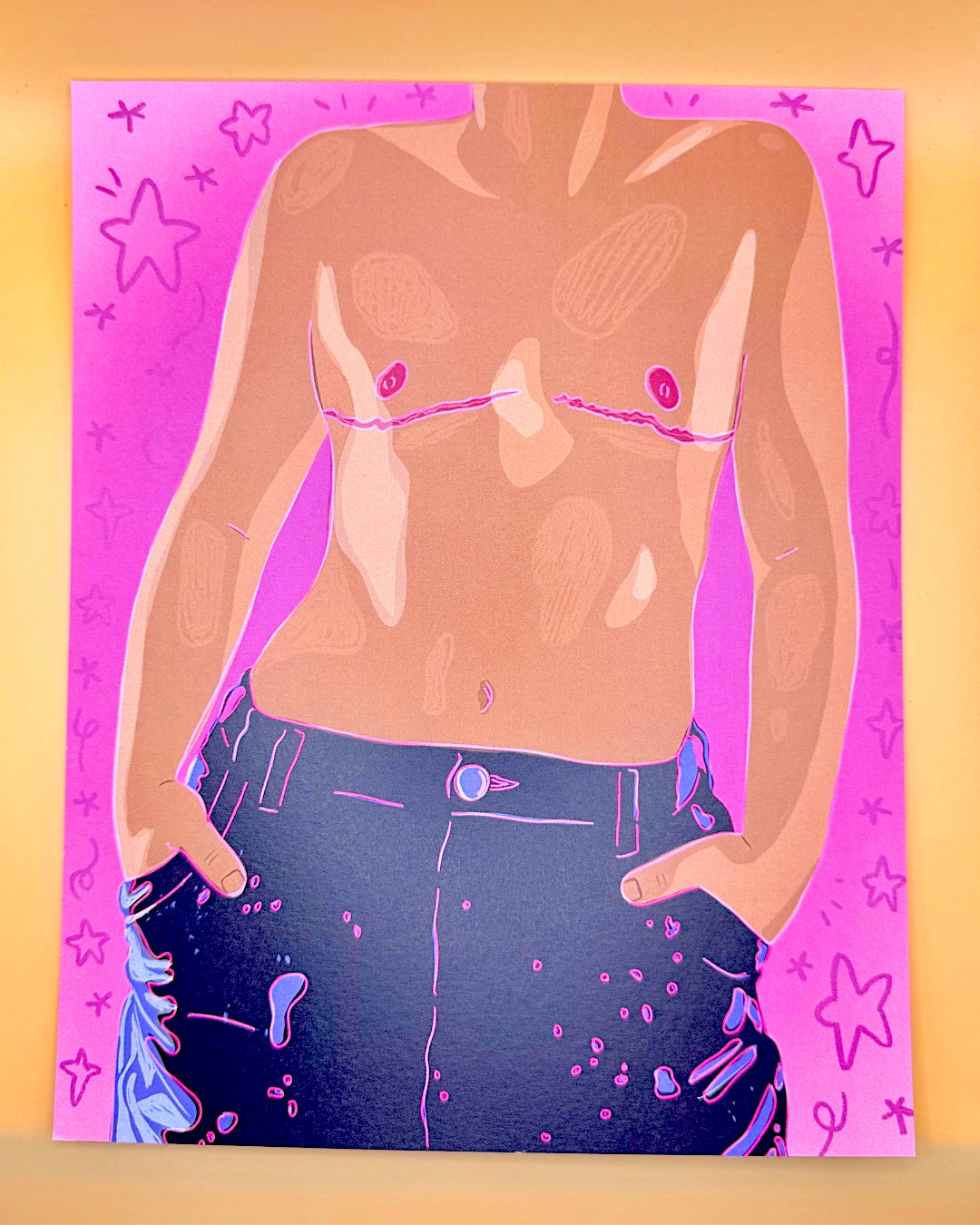 Top Surgery 8x10 Print