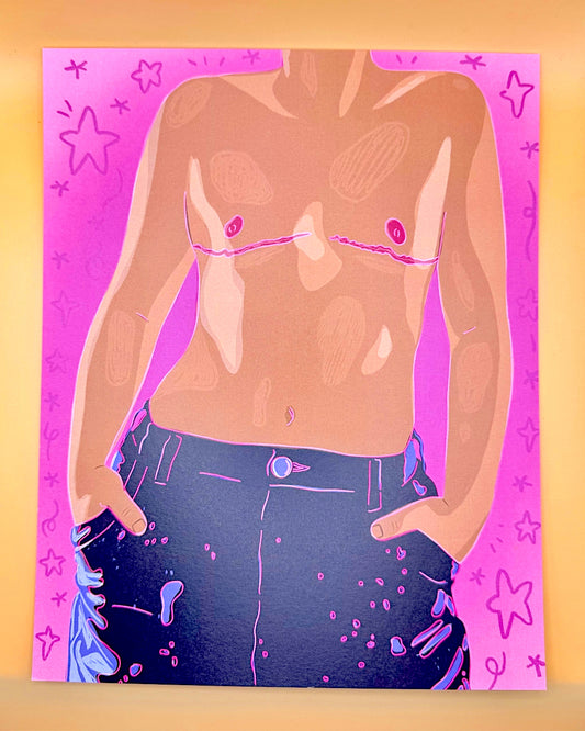 Top Surgery 8x10 Print